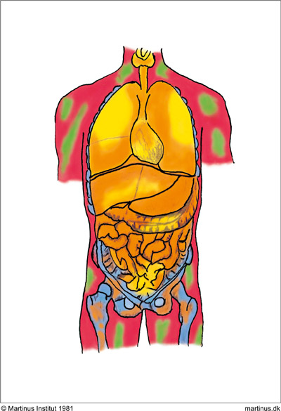 Symbol 48: Illness in the Human Organism