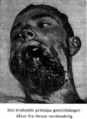 Det dræbende princips genvirkninger Såret fra første verdenskrig