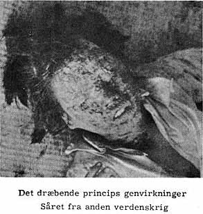 Det dræbende princips genvirkninger Såret fra anden verdenskrig